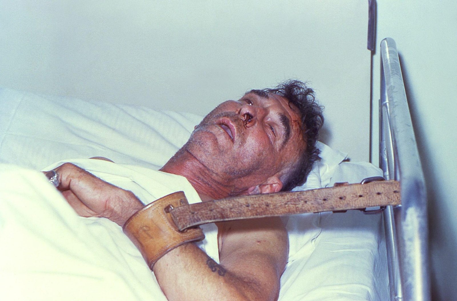 Rabies Alert Unveiled: Understanding the Risks and Implications for the Viera Community