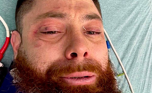 Brevard Community Rallies Around Fishlips Employee Michael Fritz After Devastating Motorcycle Accident